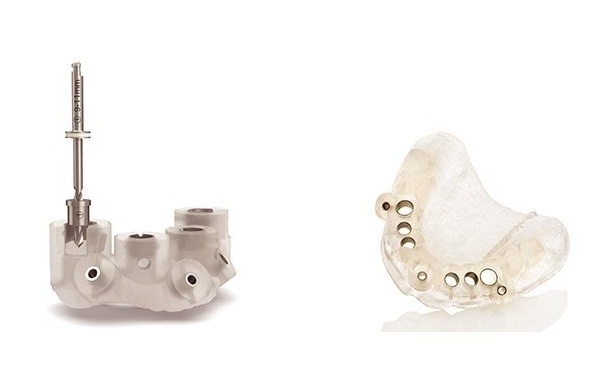 健康・医学 216 IMPLANTS Ultimate guide The Ultimate Guide To Dental Implants | Published